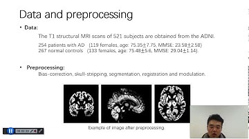 Lightweight Spatial Attention Module with Adaptive Receptive Fields in 3D CNN for AD Classification