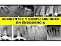 "ACCIDENTES Y COMPLICACIONES EN ENDODONCIA" por el Dr. Bruno Lujan