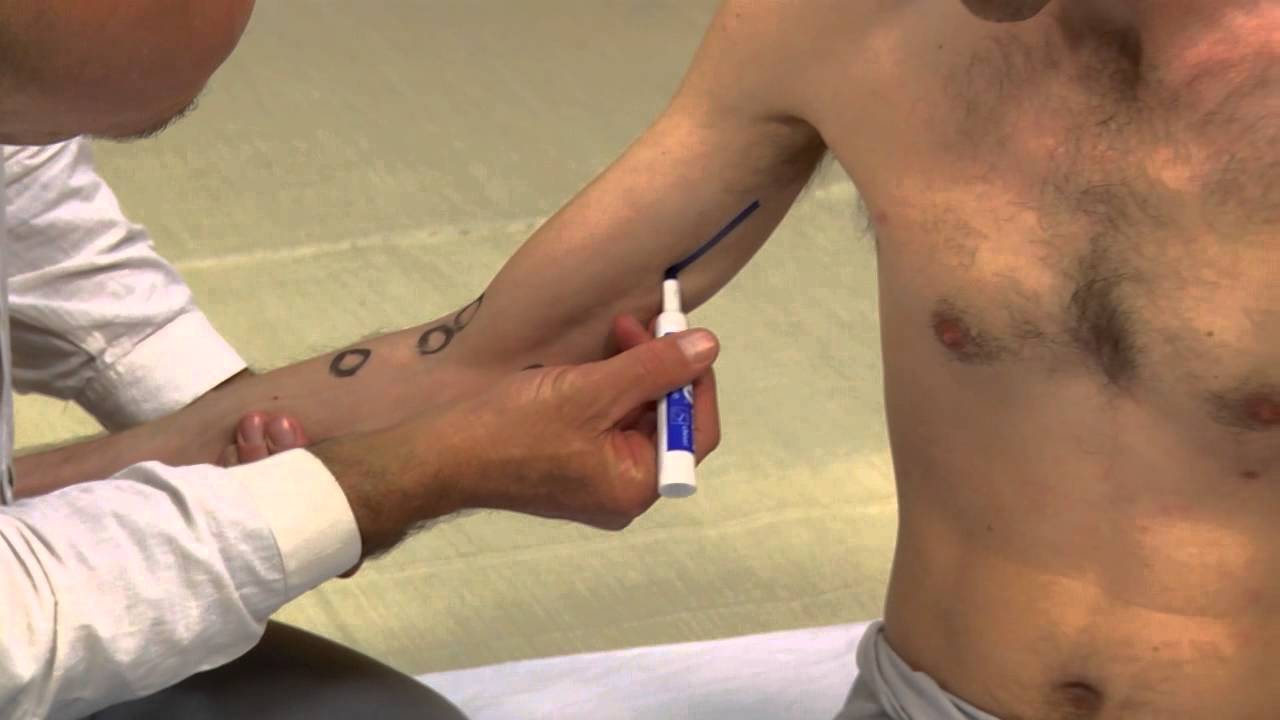 Thai Acupressure - Stiffness with pain when bending and straightening the Elbow - Full Course Below