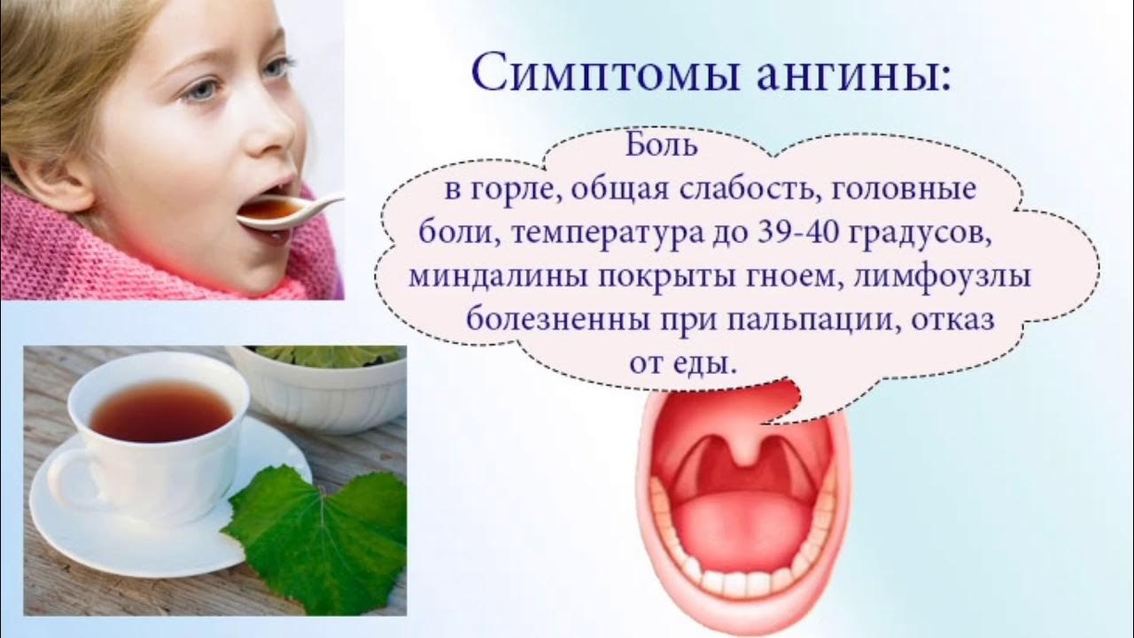 Как можно быстро вылечить горло. Как можно быстро вылечить горло