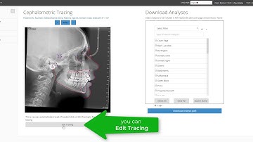 CephX | Uploading New Cephalometric X-ray for Tracing & Analysis