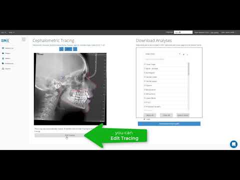 CephX | Uploading New Cephalometric X-ray for Tracing & Analysis