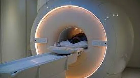 Does Migraine Cause MRI Abnormalities?