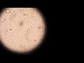 Giardia Cysts In Stool Human Visible To Naked Eye
