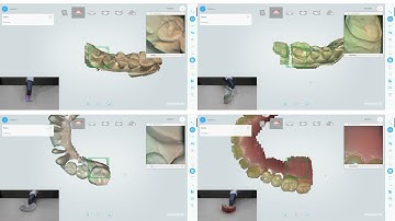 Aoralscan - Intelligent software scanning