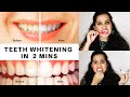 🔴❌ How To Whiten Teeth at Home in 2 Minutes 🔥