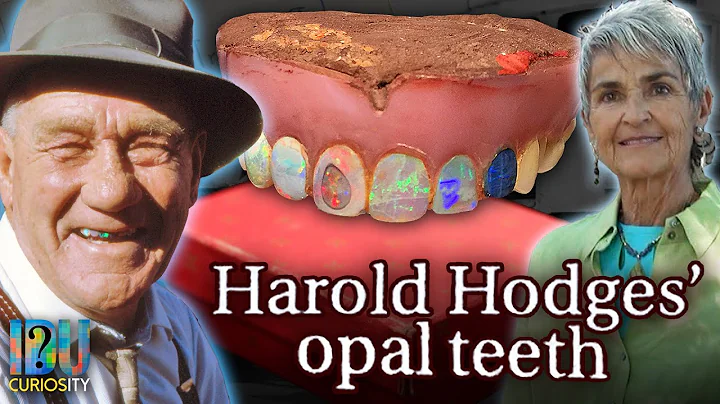 Teeth and Trams - Harold Hodges' Opal Teeth