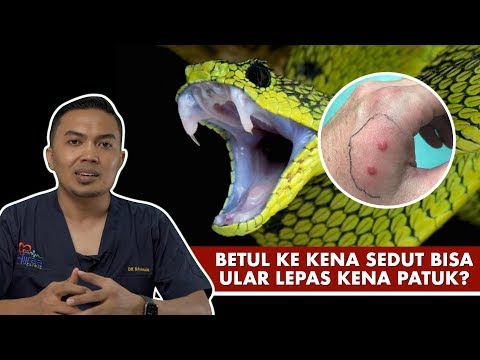 Betul Ke Kena Sedut Bisa Ular Lepas Kena Patuk?