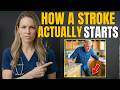This Is How a Stroke REALLY Starts: 5 Warning Signs You Ignore Every Day