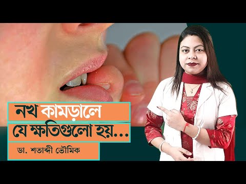 ভিডিও: আঙ্গুল চুষে, নখ কামড়ে। সাইকোথেরাপিস্টের যুক্তি