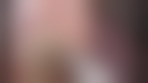 Mesenteroaxial gastric vovulus _[part 2]_Laparoscopic segmental gastrectomy for failed gastropexy