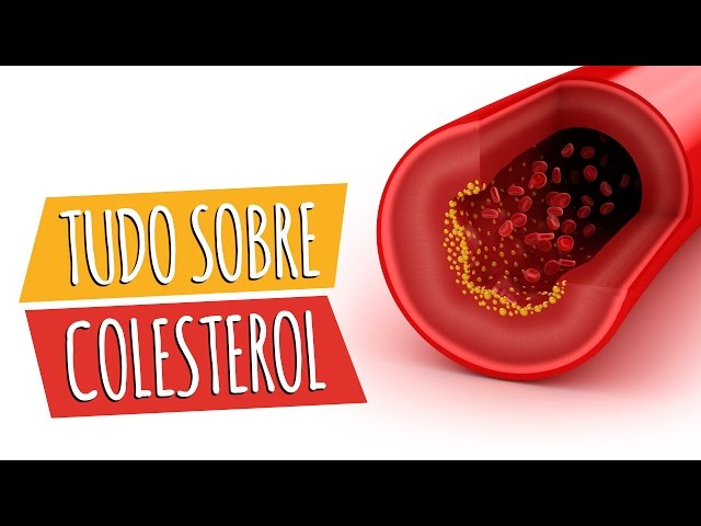 dieta per alti trigliceridi e colesterolo alto