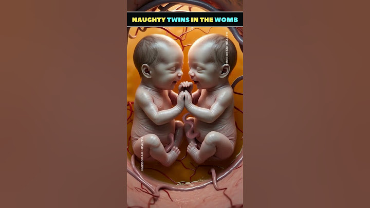 Twins | Twin Pregnancy | Babies in the womb | Multiple Pregnancy #shortsfeed #twins #baby