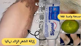 معجزة ربانيه ازالة الشعر تحت الجلد _ لإزالة شعر الوجه والجسم كله من الجذور بدون ألم