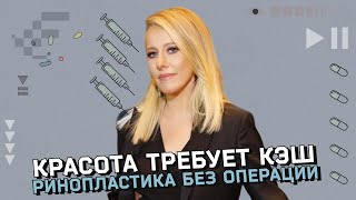 Гормоны в косметологии: что такое безоперационная ринопластика. Большое бьюти-расследование