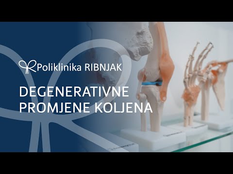 Liječenje ozljede koljena | Poliklinika Ribnjak - "Zdravlje na kvadrat"