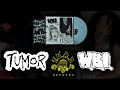 Wbi  tumor  split lp