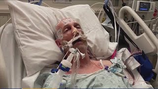 Medical marvel: Houston man survives same head trauma Bob Saget died of