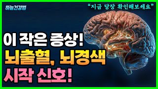 절대 놓치면 안 되는 뇌졸중 신호! 뇌출혈, 뇌경색 전조 증상, 초기 증상 한눈에 요약정리