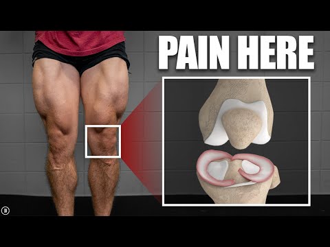 Meniscus Tear Rehab & Exercises (Stretching | Strength | Plyometrics)