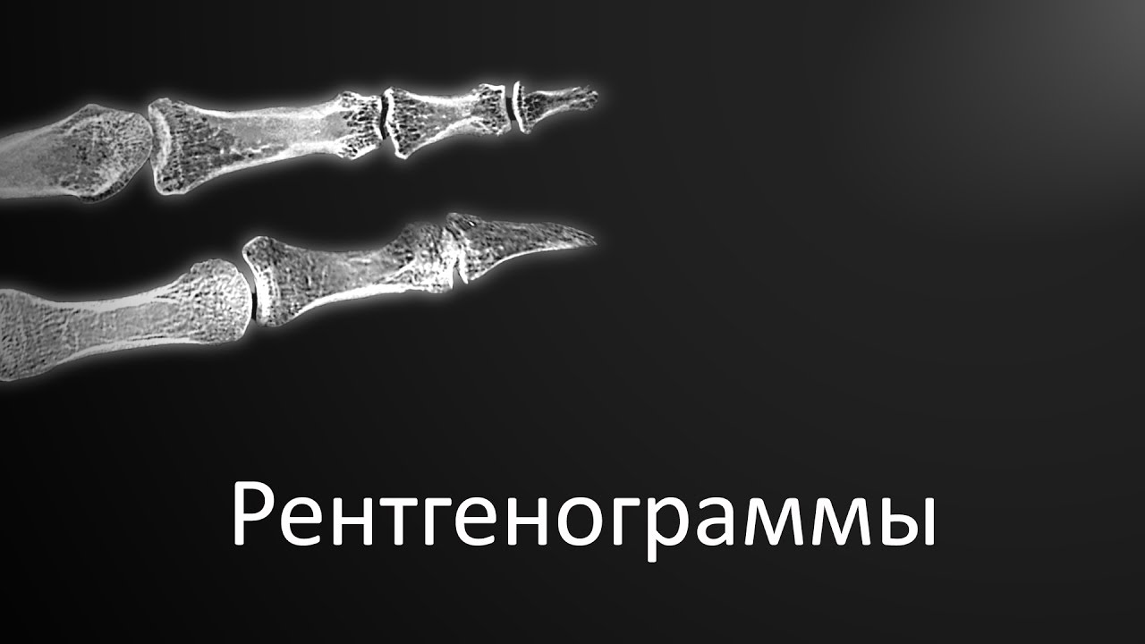 Травматология ваза медсанчасть