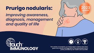 Prurigo nodularis: Improving awareness, diagnosis, management and quality of life