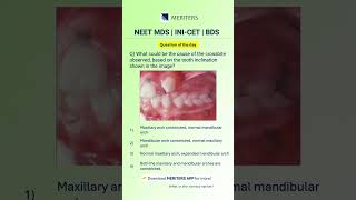 NEET MDS | INI-CET MDS | PSC | BDS - Most Important Questions #neetmdspreparation #neetmds2027