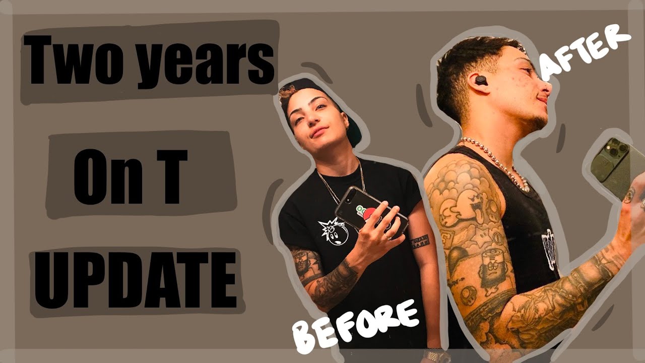 2 Years on Testosterone!!! | FTM Changes Update