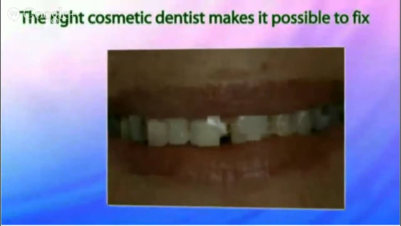 WalkIns Dentist La Mesa 619) 4441001 Dental Arts Group YouTube