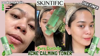 TONER UNTUK KULIT BERJERAWAT.. Review SKINTIFIC CICA TONER / Acne Calming Toner ✨