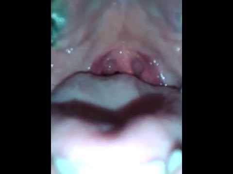 الفارق في وضعية أقصى اللسان و أقصى الحنك العلوي بين التفخيم و الترقيق في الغين و الخاء