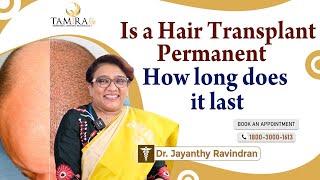 Watch Now: The Truth Revealed! Is Hair Transplant Truly Permanent? 🤔💡