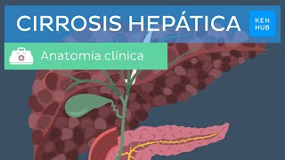 Cirrosis hepática: Definición, presentación clínica, diagnóstico, tratamiento y prevención | Kenhub