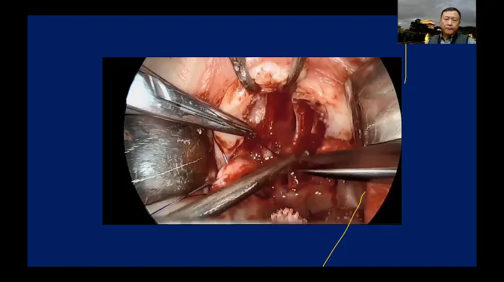 Jan. 17th. 2021 The International Craniofacial Cha...