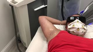 Laser Hair Removal Patch Test Underarms