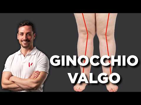 Video: 4 modi per aggiustare le ginocchia iperestese