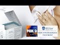 New FDA Approved Treatment for Hyperhidrosis - SLUCare Health Watch