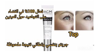 كريم حول العينين ACM duolys لعلاج التجاعيد والهالات والانتفاخات خطير يا البنات