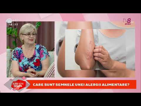 Video: Cum Să Călătorești Cu O Alergie Severă La Nuci