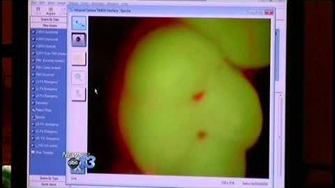 Spectra Live on ABC WLOS with Dr  Schluentz