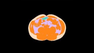 CT Abd Fat Analyser HowTo