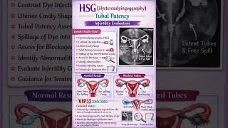 HSG Procedure for Pregnancy | Infertility Test Every Woman Should Know #pregnancy #shorts #trending