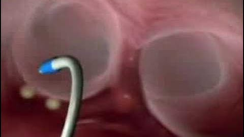 How Can A Robot Save Hearts?