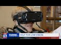 IrisVision Electronic Glasses Helps Those with Macular Degeneration