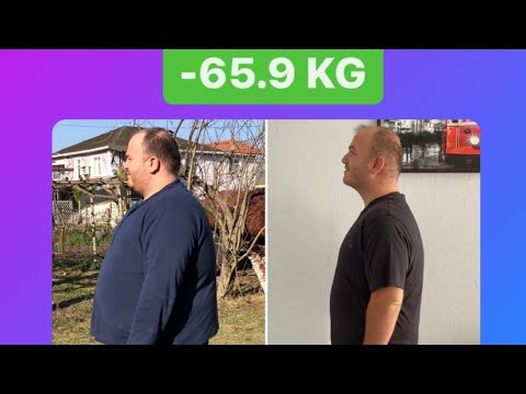 Diyet ve Spor Yaparak 65 Kilo Verirken Yaşadığım Değişim