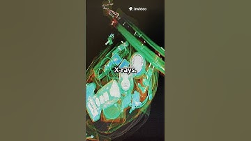 You Won’t Believe What Sets Off Airport Scanners!