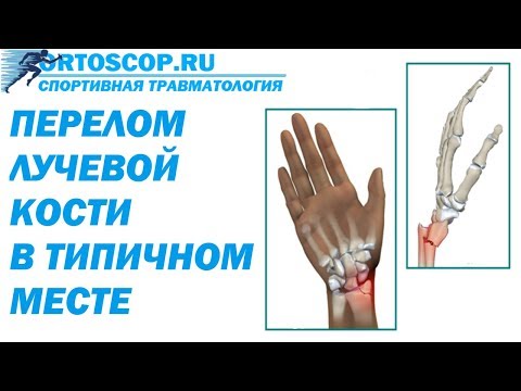 Видео: Какая кость в области предплечья находится со стороны большого пальца?