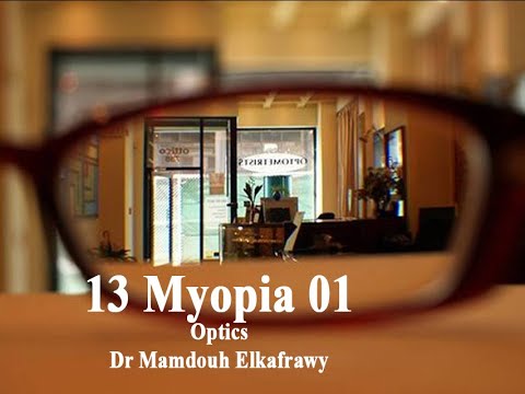13   1 الكفراوي أوبتكس   