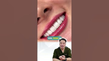 Tạm biệt ố vàng, tự tin mọi nơi #drThu #BsThu #Dansuthammy #Veneer