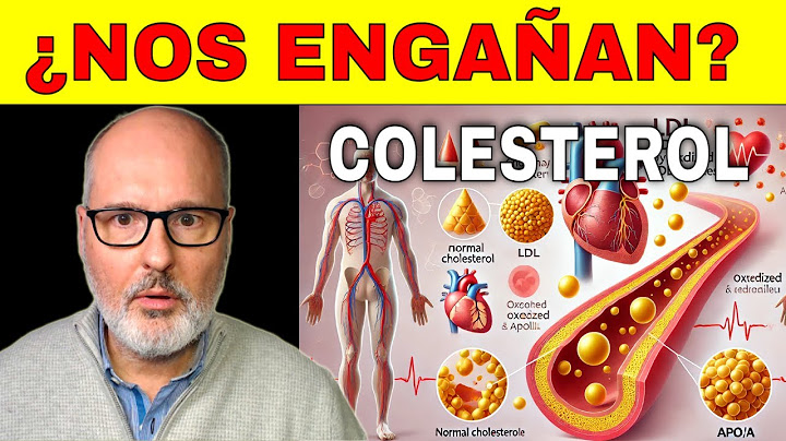 La VERDAD del COLESTEROL que NO te explican (según la CIENCIA)